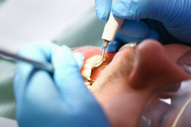 Best Dental Abscess Treatment in Zeeland, MI
