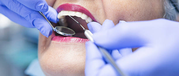 Best Lost Filling or Crown Replacement in Zeeland, MI